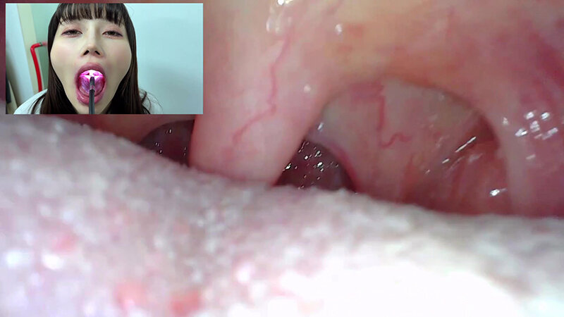 【特価】口腔観察VOL.2 4名55分お買い得セット││セット商品│h_1651nko00005